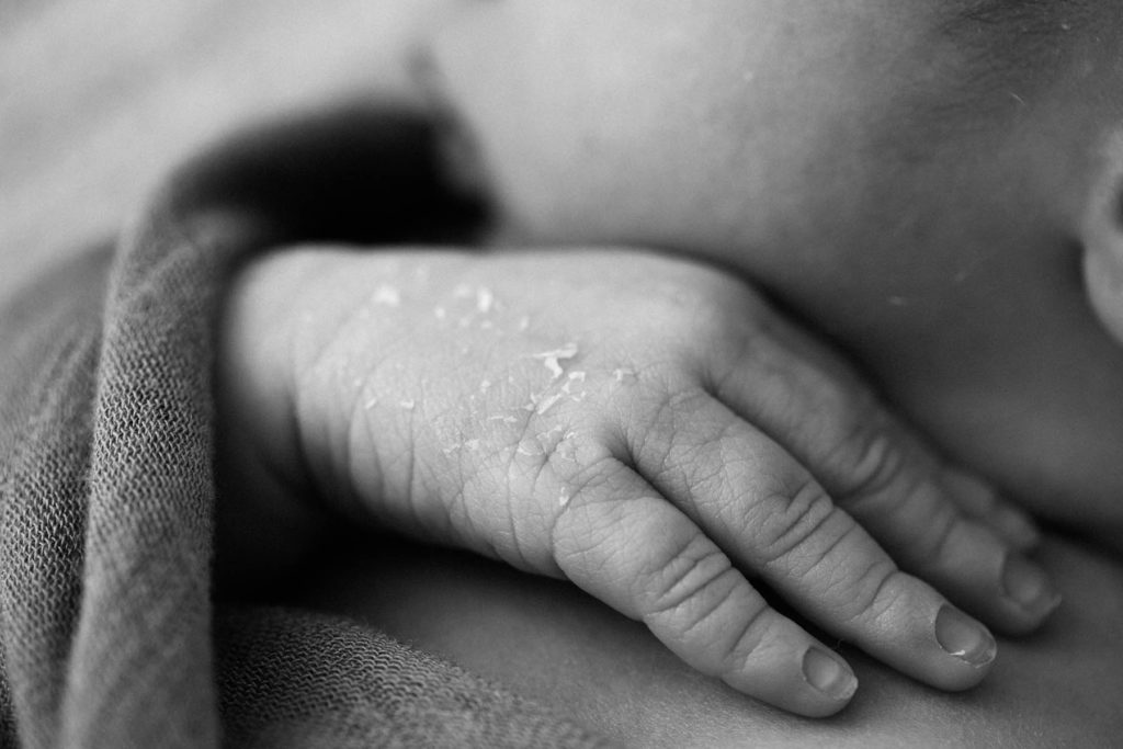 Macro photograph of a newborn baby's hand with skin flakes 